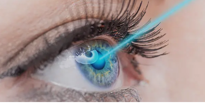 SMILE Laser Eye Surgery_ A Safe, Effective Vision‑Correction Option for Adelaide Residents1